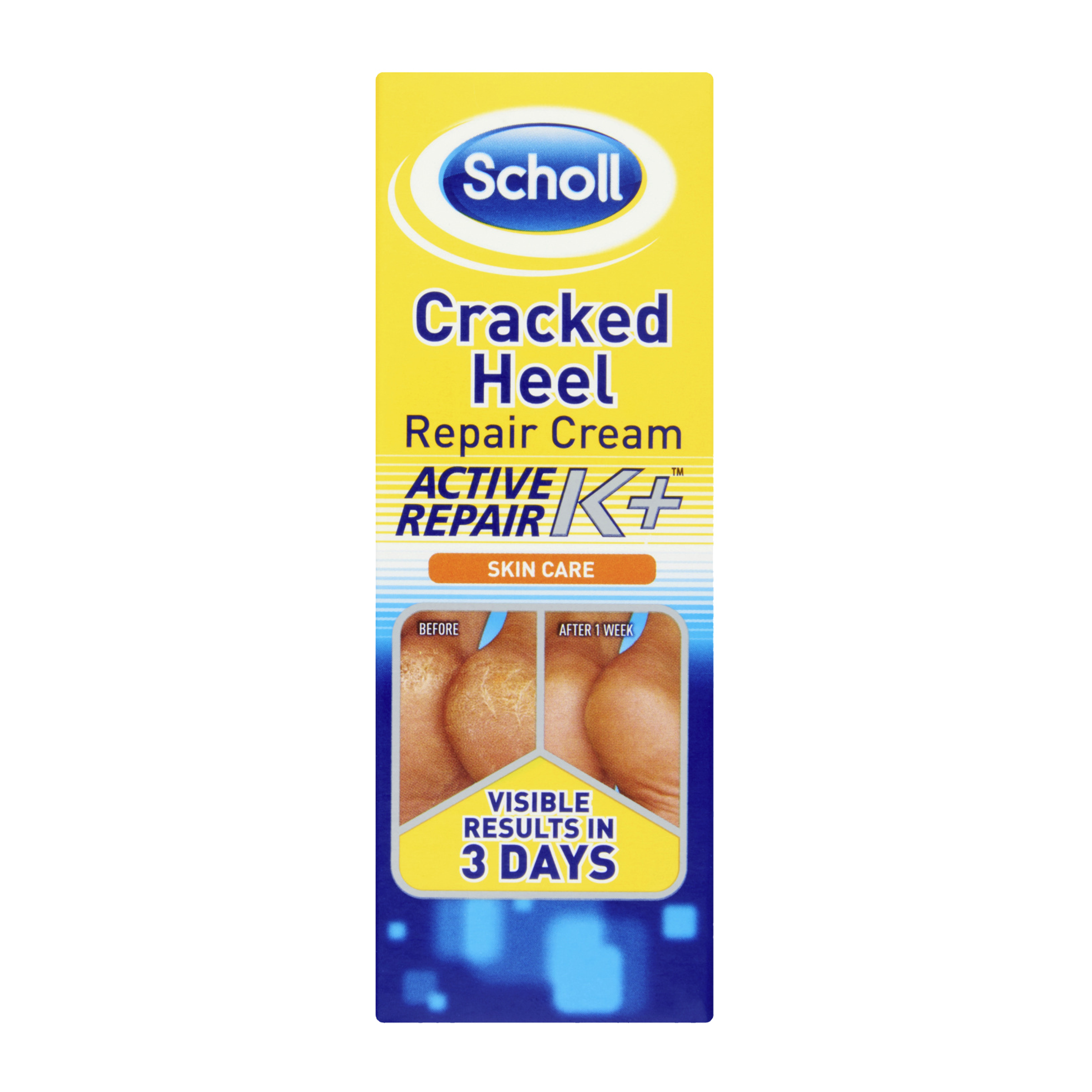 Scholl Balzám na popraskané paty K+ 60 ml
